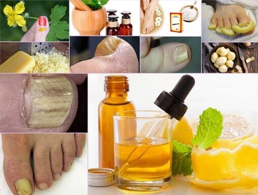 Remedios populares para tratar fungos nas unhas dos pés