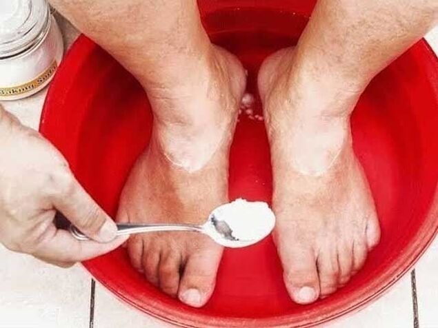 Baños de sosa para fungos