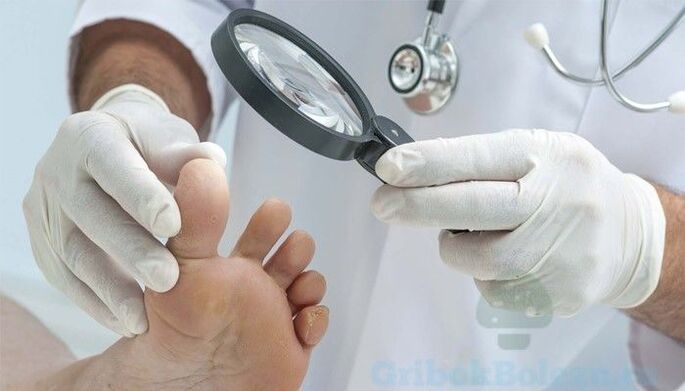 Diagnóstico do pé de atleta por un médico