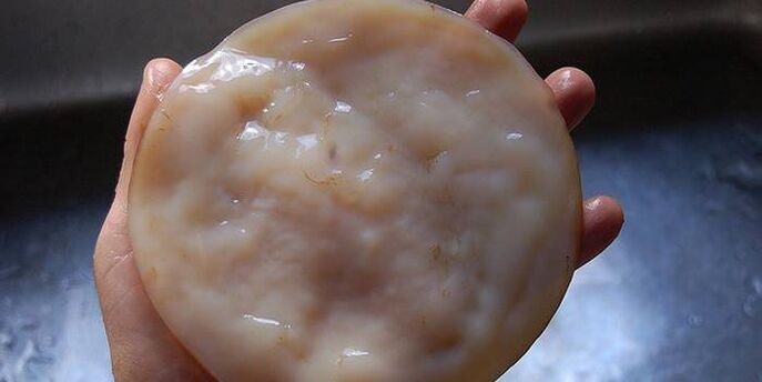 Kombucha para fungos nas unhas