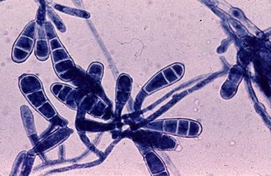 As bacterias causan fungo das uñas